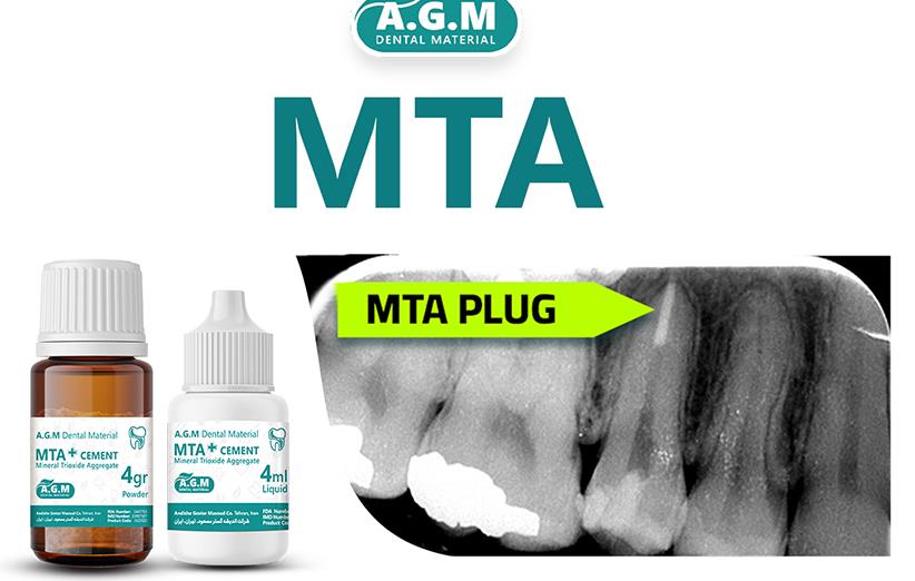 درباره MTA بیشتر بدانیم
